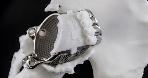 Brian McLaughlin comments on 3D Printing’s Important Role in the Future of Personalized Patient Care