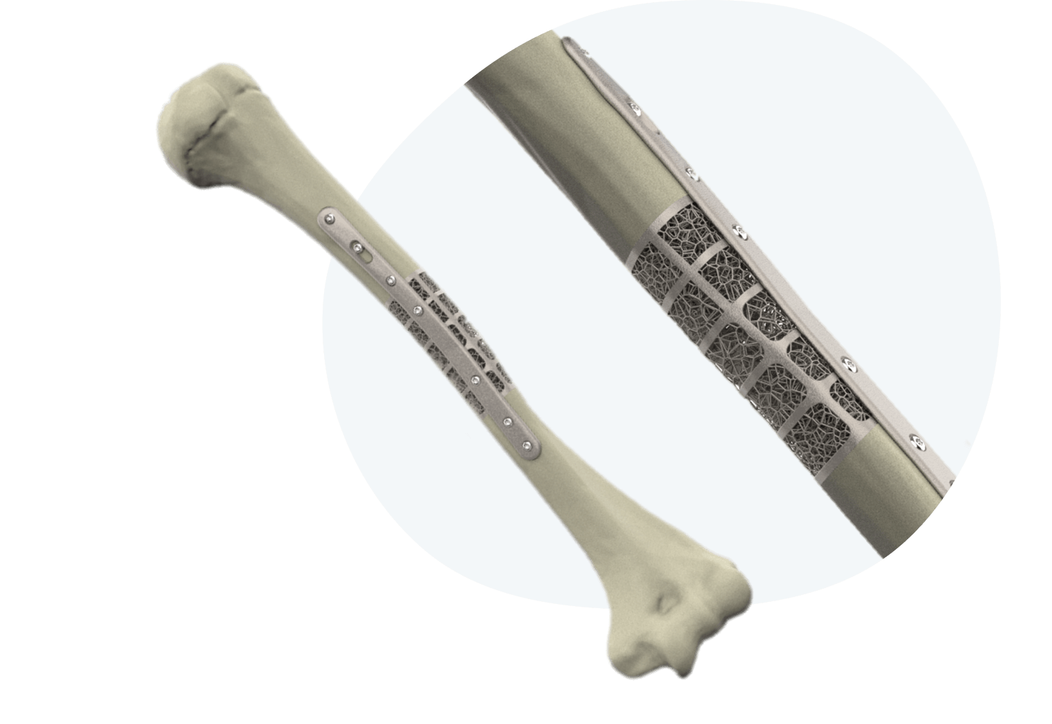 hero-bone