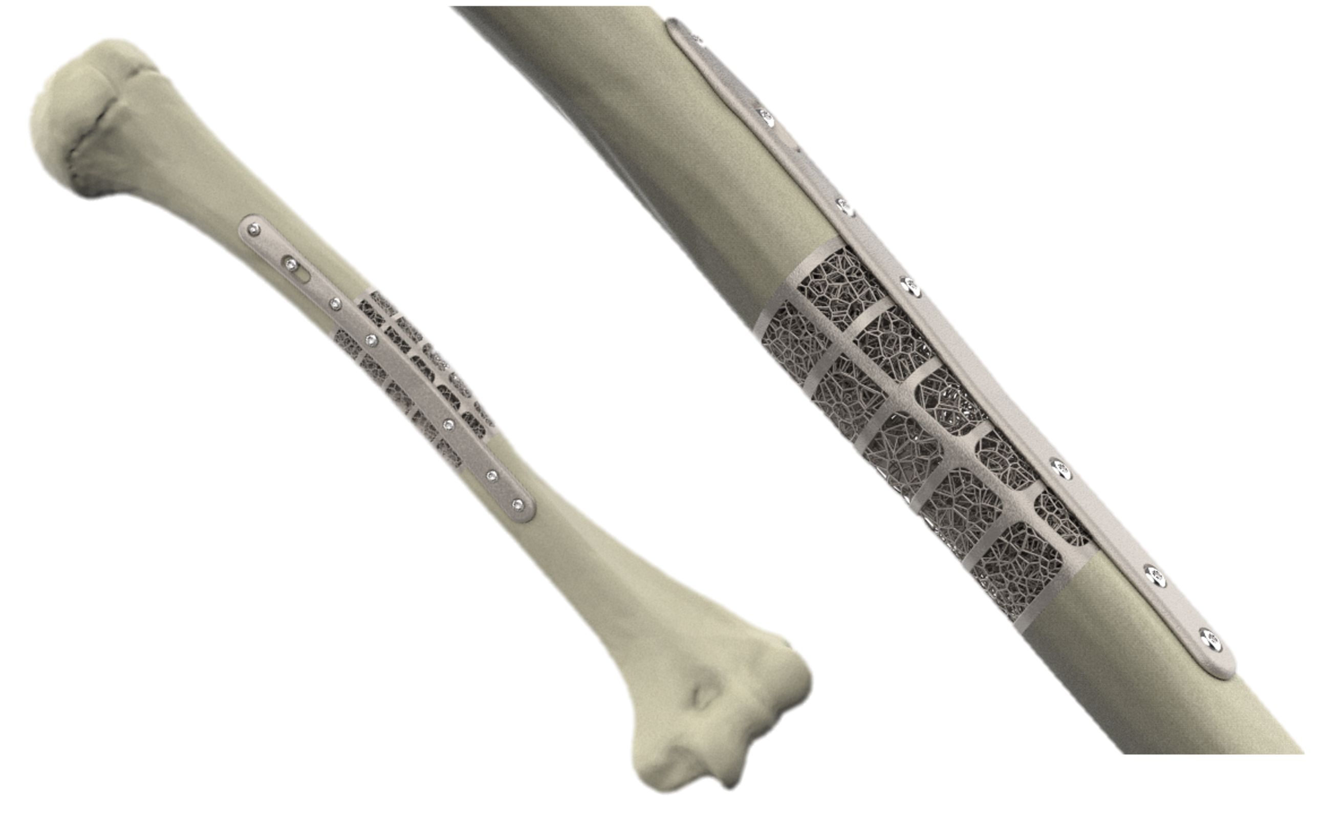 Humerus group 2